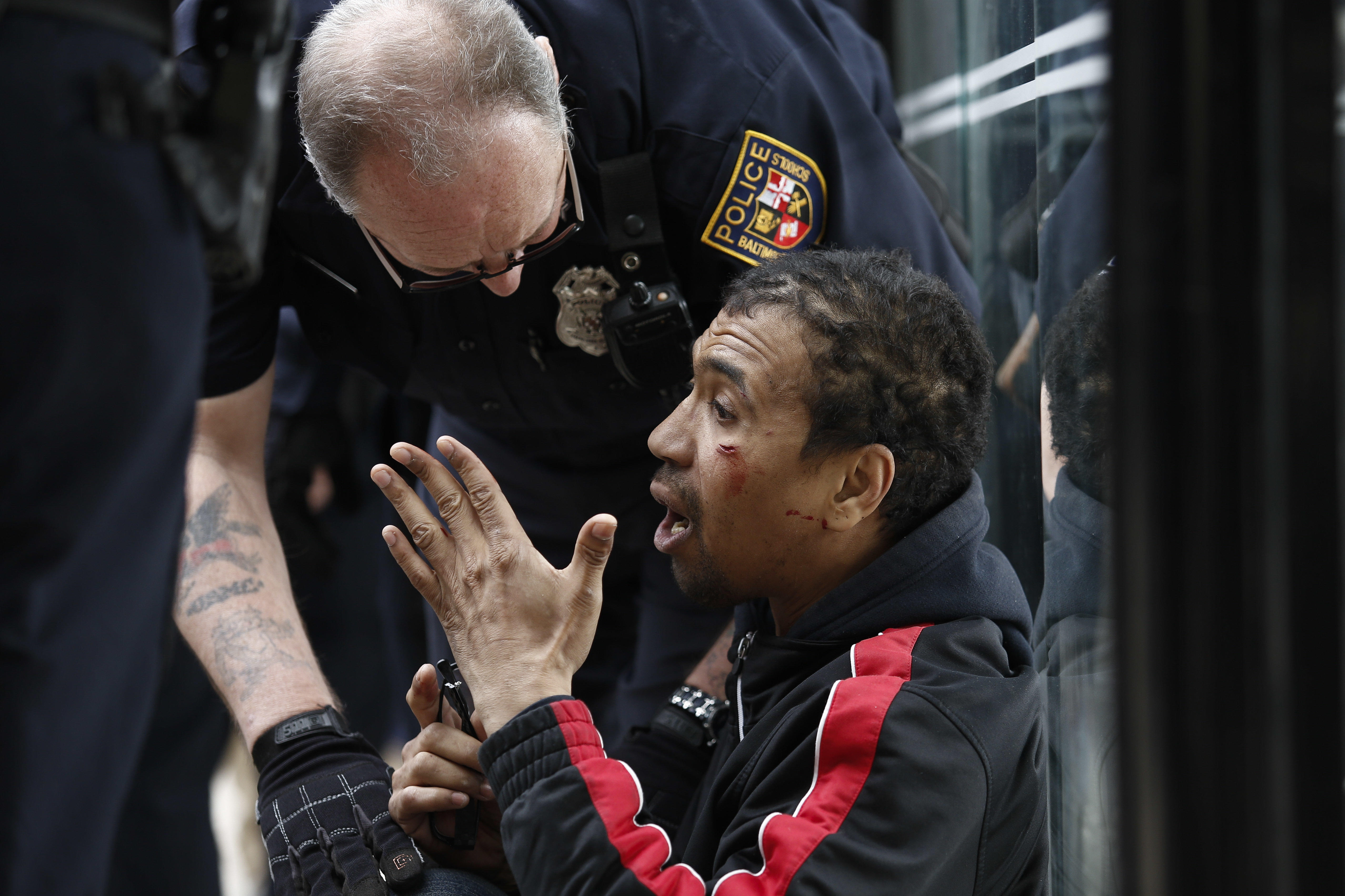 Baltimore Man Hurt During Protest