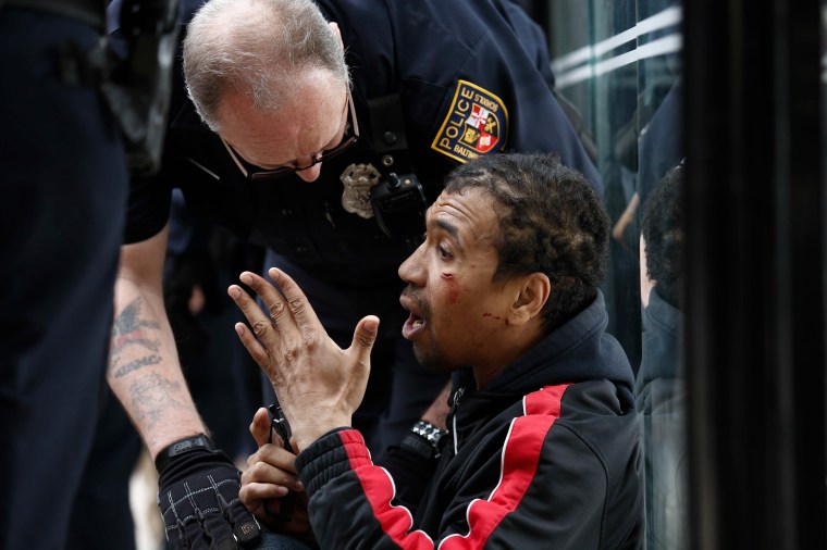 Baltimore Man Hurt During Protest