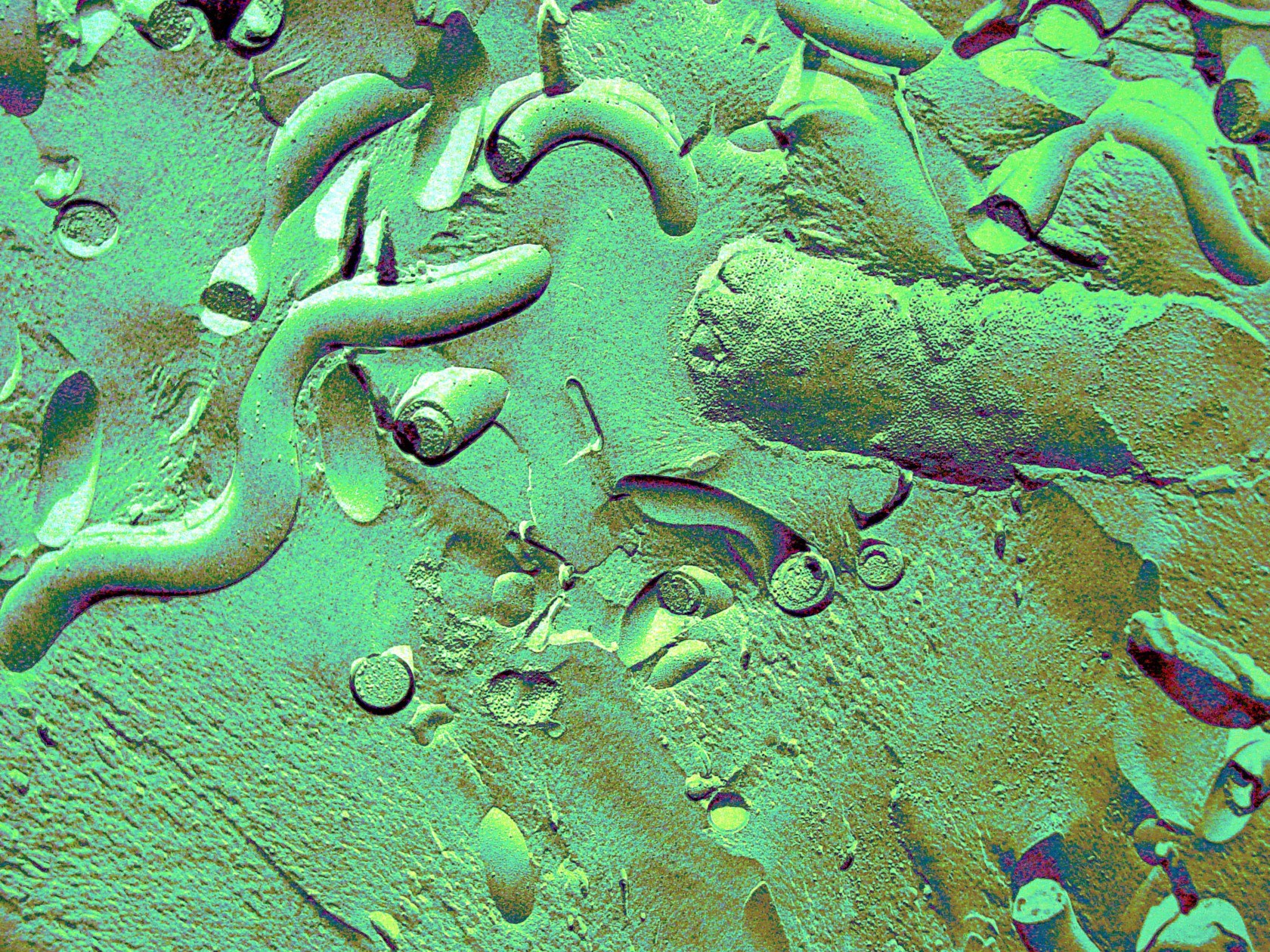 TEM FREEZE FRACTURE OF TREPONEMA AND E. COLI