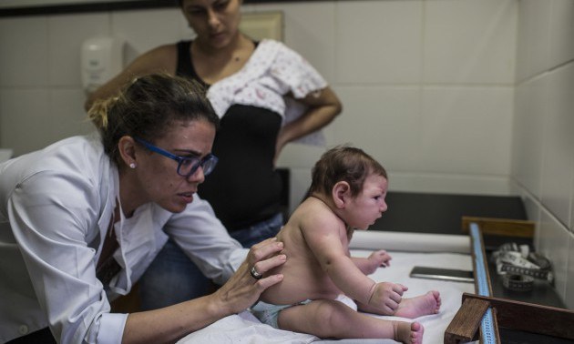 Suspected zika-related microcephaly in Brazil