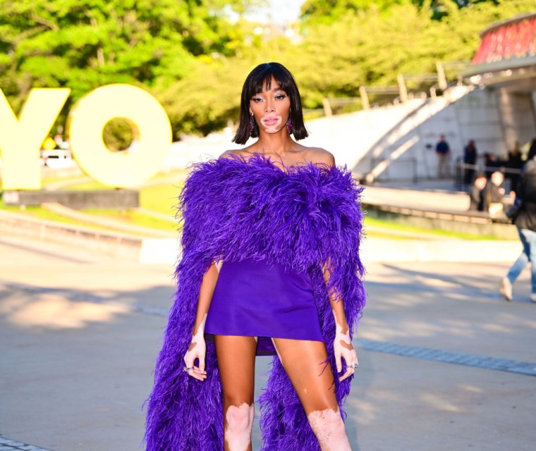 Winnie Harlow