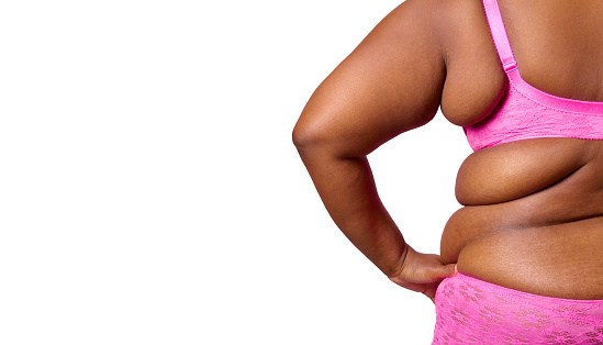 Obese woman rear view