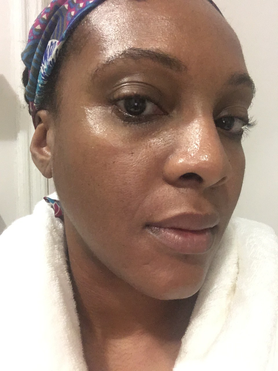 Danielle James - Laser Facial