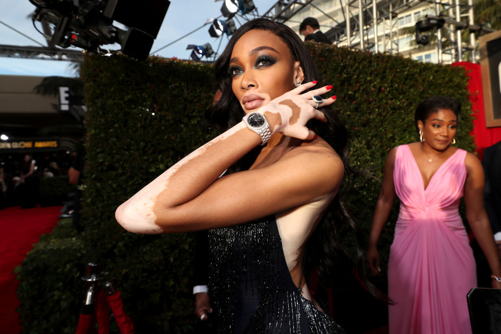 Winnie Harlow