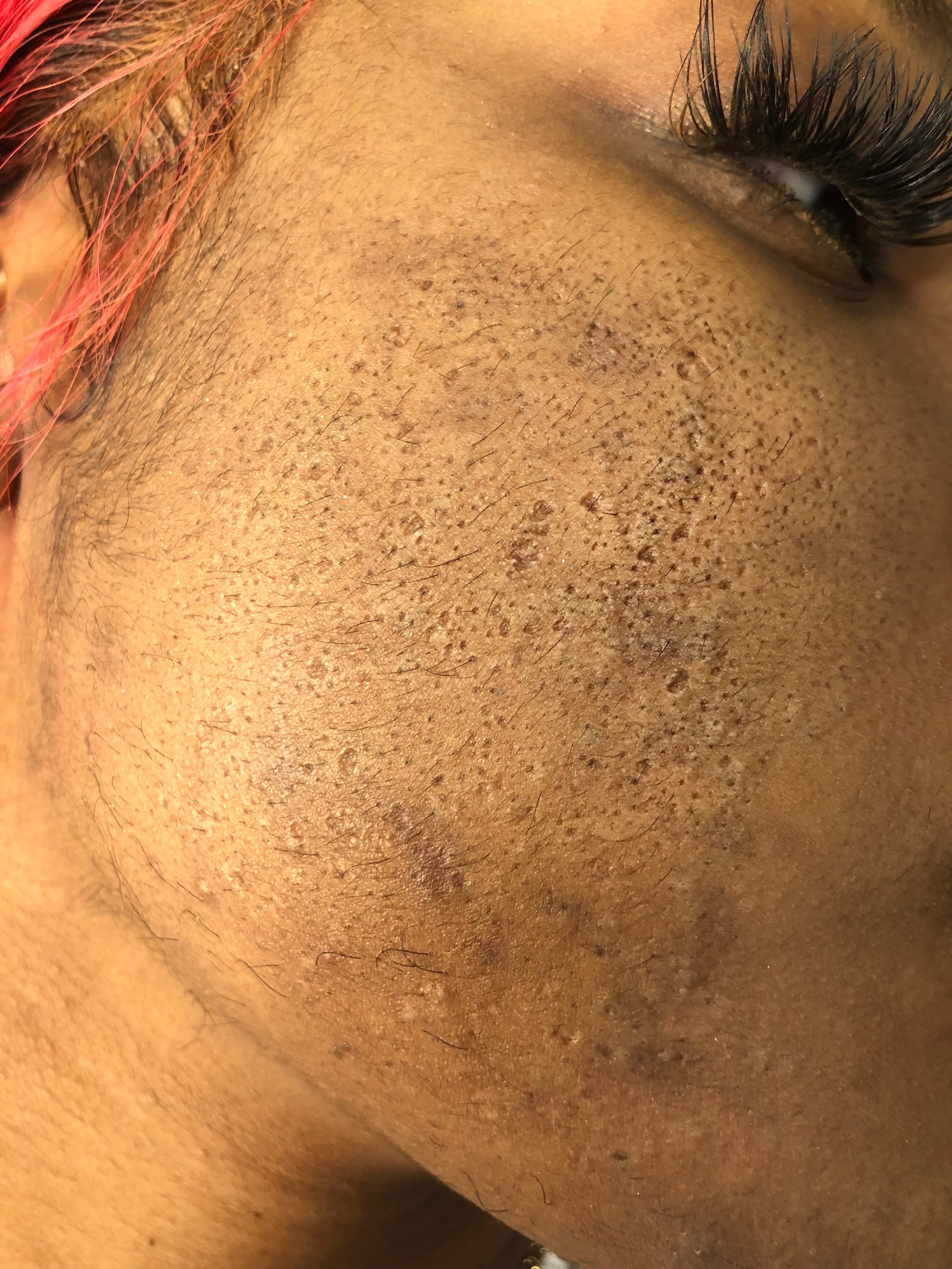 Ti Taylor/ UnderneathSkinCare