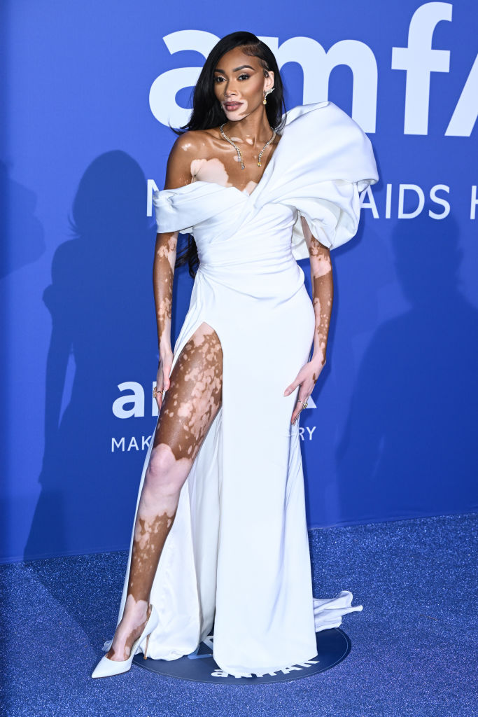 Winnie Harlow