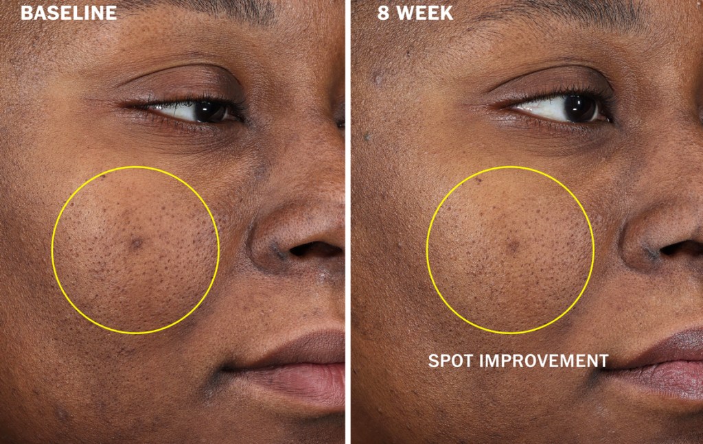OLAY Super Serum