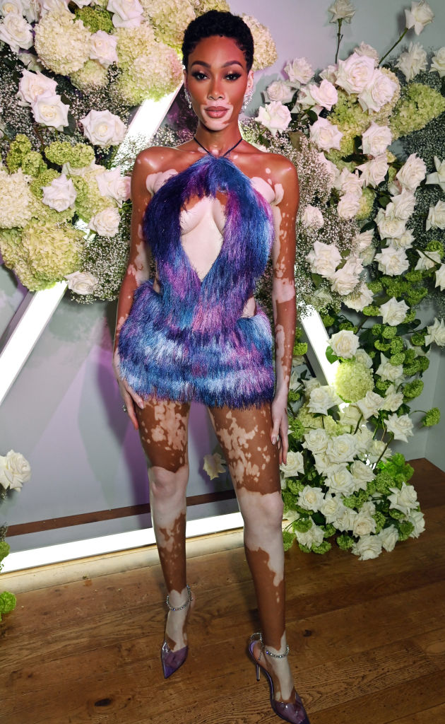 Winnie Harlow
