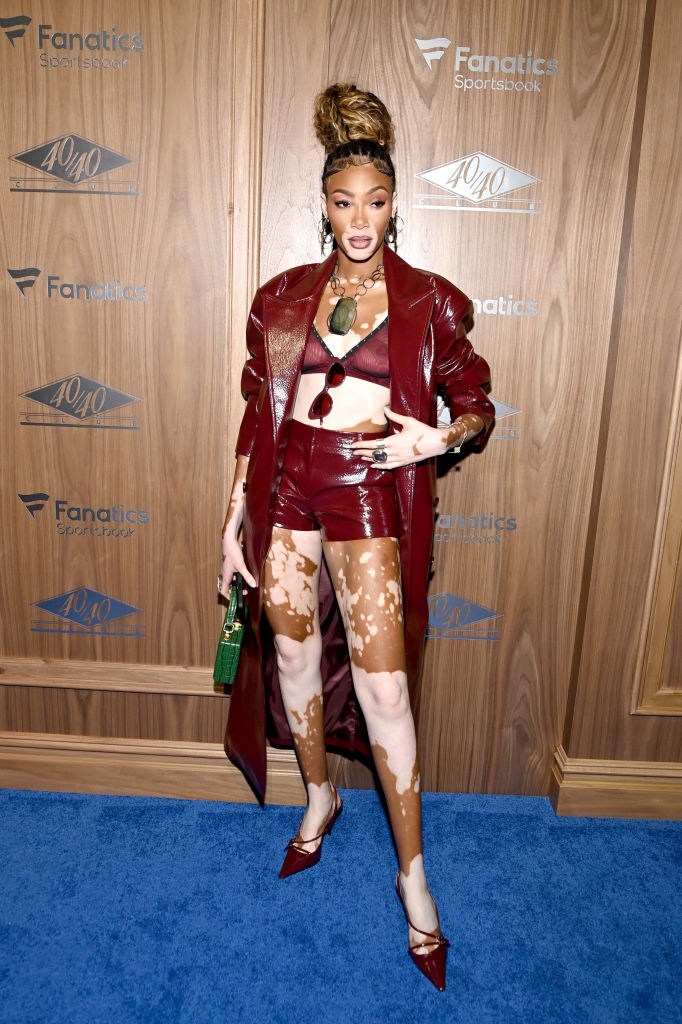 Winnie Harlow