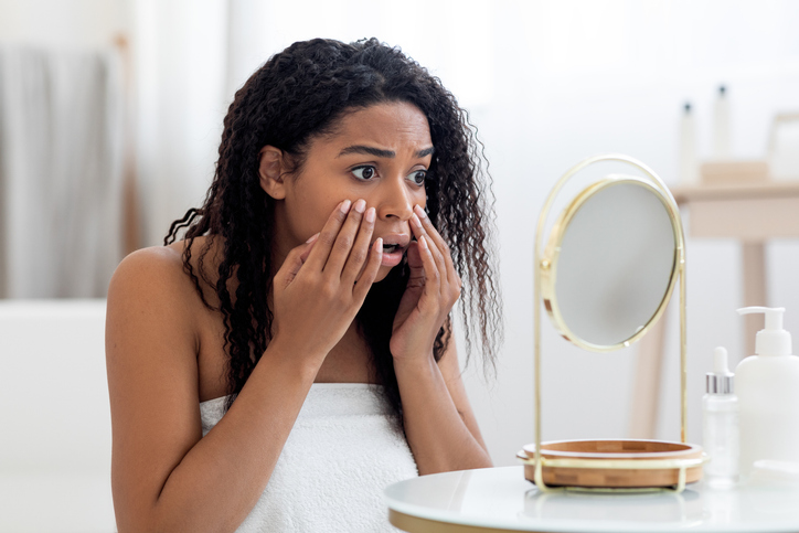 Skin Problems Concept. Shocked Black Female Looking At Mirror And Touching Face